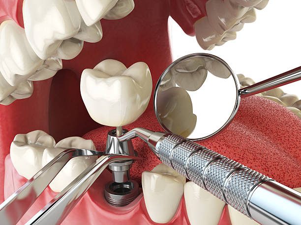 Best Walk-In Emergency Dentist in USA